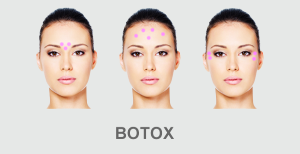 botox toksyna botulinowa